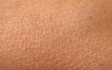 الصيام علاج فعال للأمراض الجلدية